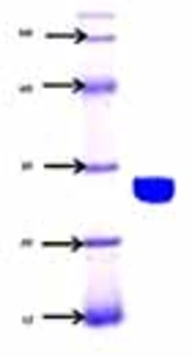 Optimization and Molecular Detection of Neuraminidase Gene in <i>Listeria monocytogenes</i>