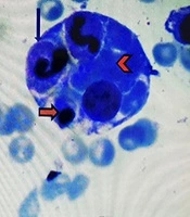 Archives of Pediatric Infectious Diseases