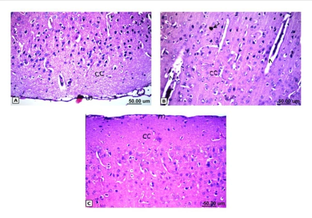 Histopathological results of rat brain area of meninges (m) and cerebral cortex (cc). (A) Normal control group: normal structure of meninges (m) and cerebral cortex (cc). (B) Rat administered AlCl3: the cerebral cortex showed congestion in the blood capillaries with degeneration in some neuronal cells. (C) Rat treated with i.v. nano-HAp after AlCl3: normal structure of meninges (m) and cerebral cortex (cc)