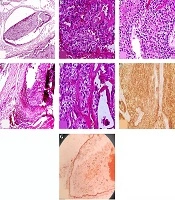 Int J Endocrinol Metab