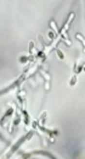 Determination of Changes in the Expression of <i>MIR-212</i> and <i>EGFR</i> Genes in Clinical Samples from Areas Infected with <i>Trichophyton rubrum</i> Compared with Non-Infected Areas