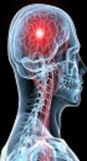 Comparison of Solitaire-FR and Trevo-ProVue Thrombectomy in Patients with Anterior Circulation Large Artery Occlusion