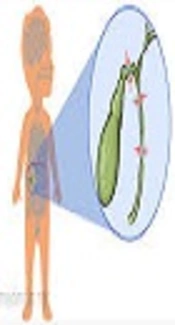 Validation of Aspartate Aminotransferase to Platelet Ratio for Diagnosis of Hepatic Fibrosis and Prognostic Prediction of Infants with Biliary Atresia after Portoenterostomy