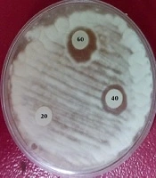 Jundishapur Journal of Natural Pharmaceutical Products