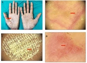 J Skin Stem Cell