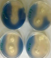 Archives of Clinical Infectious Diseases 
