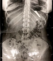 Int J High Risk Behav Addict