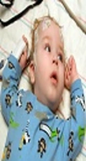 Seizure as the Early and Main Manifestation of Infantile Vanishing White Matter Disease: A Case Report