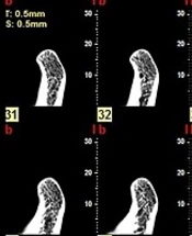 Iranian Journal of Radiology