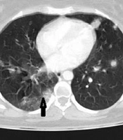 International Journal of Cancer Management