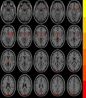 Iranian Journal of Radiology