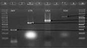 Investigation of P Fimbriae Presence in <i>Escherichia coli</i> Strains Isolated from Urine Samples in Human, and Their Antibacterial Resistance