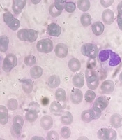 Arch Pediatr Infect Dis