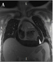 Multidiscip Cardio Annal
