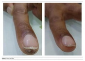 J Skin Stem Cell