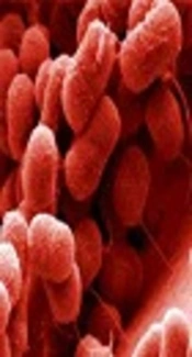 Antibiotic Resistance in <i>Acinetobacter baumannii</i> Isolated from Patients with Urinary Tract Infections in Zabol, Iran