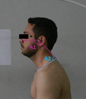Middle East J Rehabil Health Stud