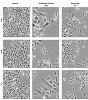 Gene, Cell and Tissue