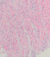 Int J Cardiovasc Pract