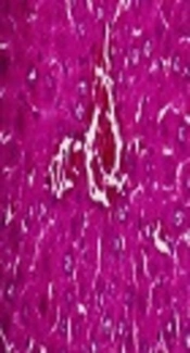 Investigating the Effect of Experimental Hypothyroidism on Insulin/Thyroid Hormones and Hepatic Steatosis
