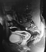 International Journal of Cancer Management