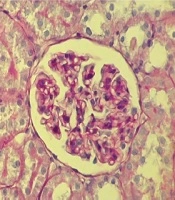 Jundishapur Journal of Natural Pharmaceutical Products