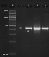 Jundishapur Journal of Microbiology