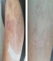 Journal of Skin and Stem Cell
