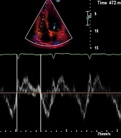 Multidisciplinary Cardiovascular Annals
