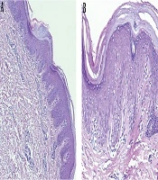 Journal of Skin and Stem Cell