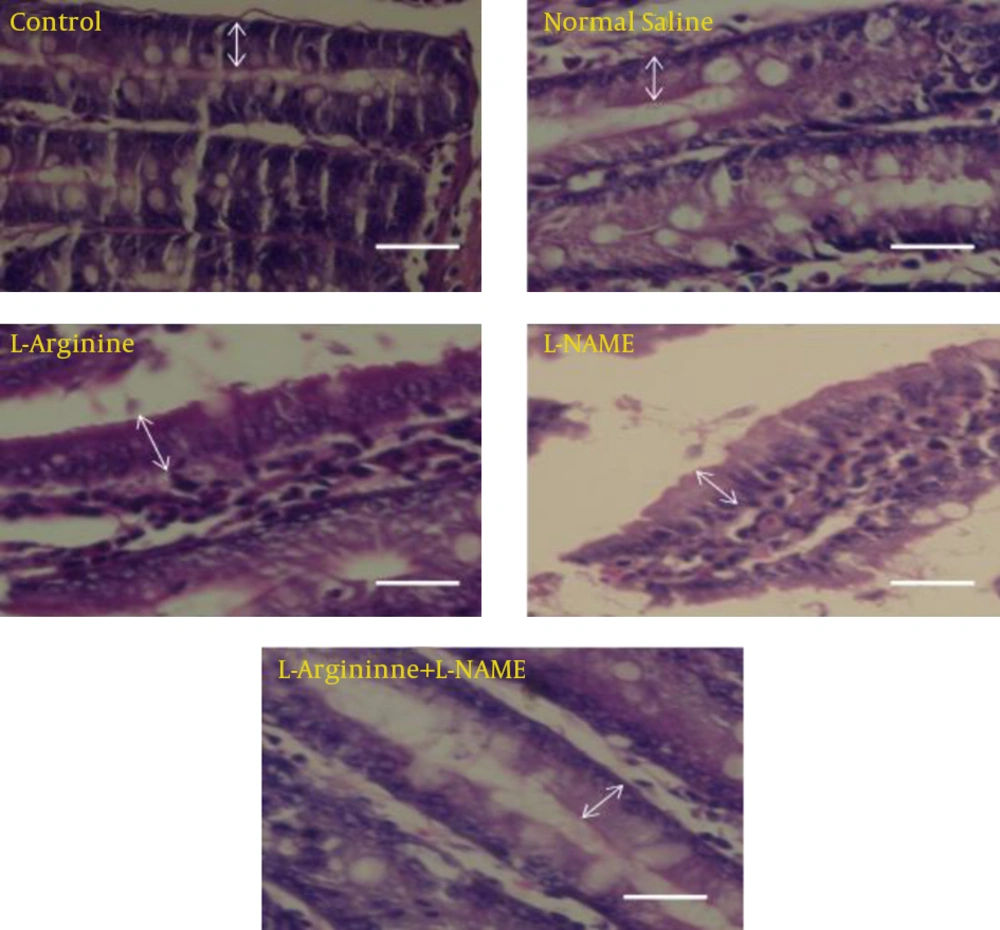 Comparative photomicrographs of different groups which show epithelial cells of jejunum and their morphological differences. Cell’s height in L-Argentine group compared with other groups was higher and as the photomicrograph shows, epithelial cells are in a compact arrangement. In L-NAME group cell number decreased and cell height increased in comparison to control and normal saline groups. But no significant difference was detected. While in L-Arginine+L-NAME group cell number increased and cell height decreased compared to control and normal saline groups. Arrows show height of cells (Hematoxylin & Eosin staining, 400X). Scale bar: 20 µm Comparative photomicrographs of different groups which show epithelial cells of jejunum and their morphological differences. Cell’s height in L-Argentine group compared with other groups was higher and as the photomicrograph shows, epithelial cells are in a compact arrangement. In L-NAME group cell number decreased and cell height increased in comparison to control and normal saline groups. But no significant difference was detected. While in L-Arginine+L-NAME group cell number increased and cell height decreased compared to control and normal saline groups. Arrows show height of cells (Hematoxylin & Eosin staining, 400X). Scale bar: 20 µm