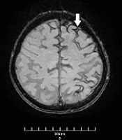 Arch Neurosci