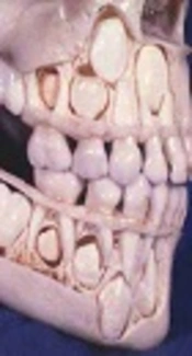 Dental Age Estimation in Southern Turkish Children: Comparison of Demirjian and Willems Methods