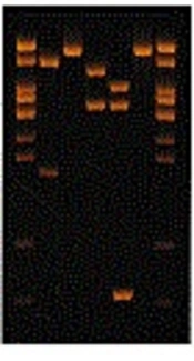 Molecular Identification of <i>Nocardia</i> Strains from the Soil by <i>hsp65</i> Gene: Polymerase Chain Reaction-Restriction Fragment Length Polymorphism (RFLP) and Analysis of Sequence 16S rRNA Gene