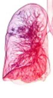 Neurally Adjusted Ventilatory Assist in Neonates: A Research Study