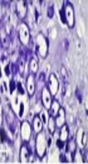 WITHDRAWN: Histological and Behavioral Alterations Following hADSCs Intravenous Administration in Alzheimer’s Rat Model