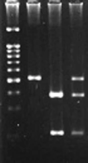 Association Study of rs763780T&gt;C IL-17F and rs2275913G&gt;A IL-17A Polymorphisms with Breast Cancer Risk in East Azerbaijan-Iran