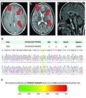Iranian Journal of Pediatrics