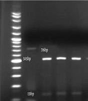 Archives of Pediatric Infectious Diseases
