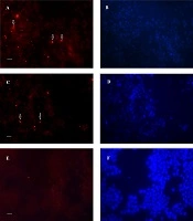 Jentashapir J Cell Mol Bio