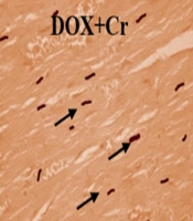 Jentashapir J Cell Mol Biol