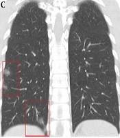 Iranian Journal of Radiology