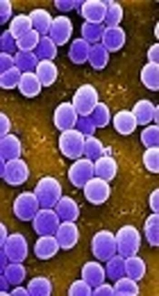 Molecular Assay of <i>Staphylococcal</i> Enterotoxin E in Synovial Fluid of Patients with Rheumatoid Arthritis