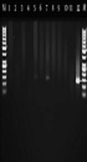 Molecular Identification and Genotyping of <i>Toxoplasma Gondii</i> in Blood and CSF Samples of Children with Immunodeficiency in Ahvaz, Southwest of Iran