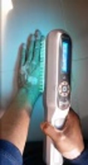 Evaluation of Serum Vitamin D Levels in Patients with Vitiligo Undergoing NBUVB (Narrowband UV-B) Therapy