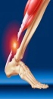 Early Short-Term Recovery of Single-Leg Heel Rise and ATRS After Achilles Tenorrhaphy: Cluster Analysis