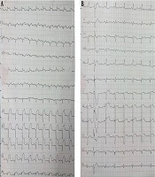 Multidisciplinary Cardiovascular Annals
