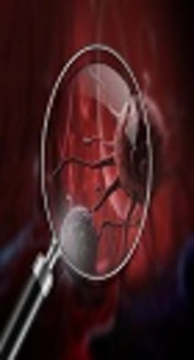 Tumor Necrosis, Pyrostar