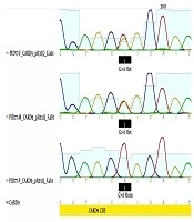 Jundishapur Journal of Microbiology