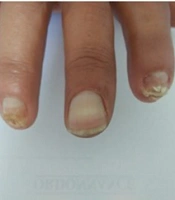 J Skin Stem Cel
